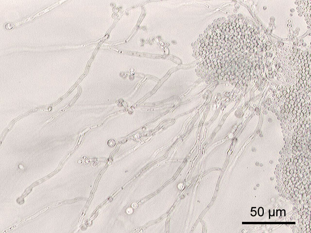 Hefepilz Sorte Candida-albicans